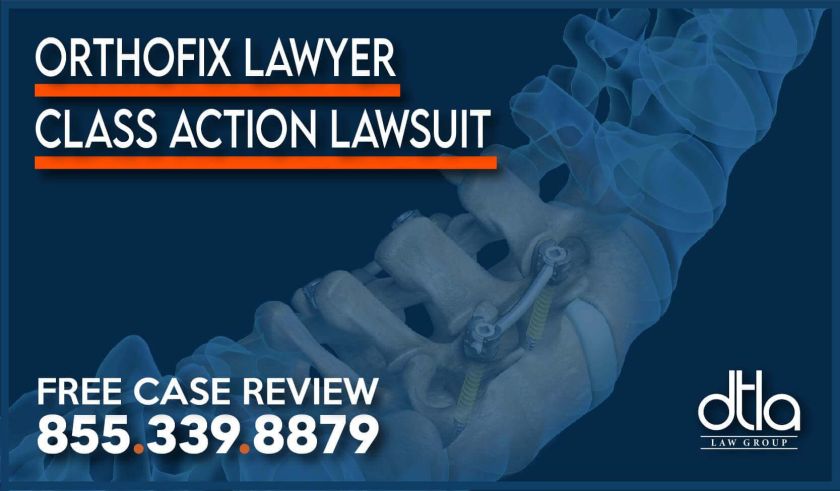 Orthofix Lawyer – Class Action Lawsuit defect personal injury accident incident attorney sue compensation