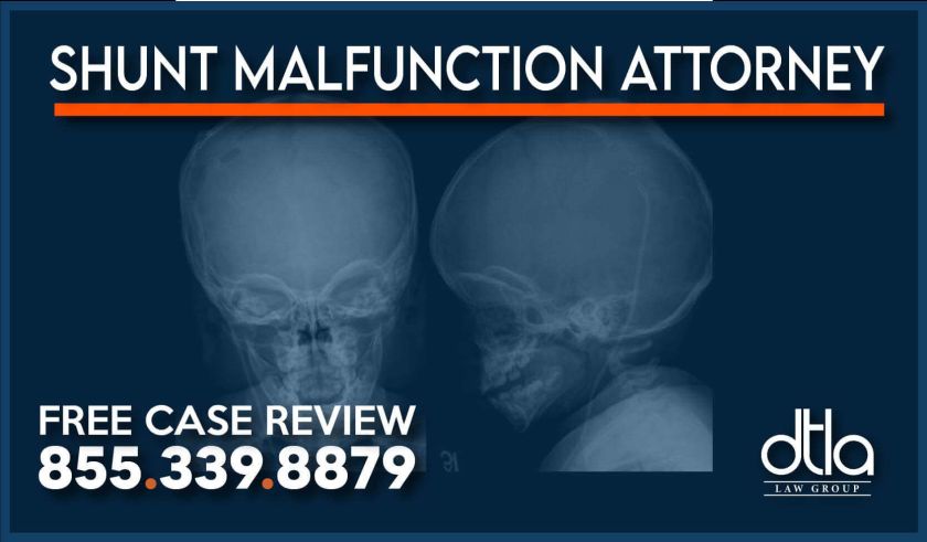 Shunt Malfunction Attorney lawyer sue compensation lawsuit attorney malpractice personal injury incident accident