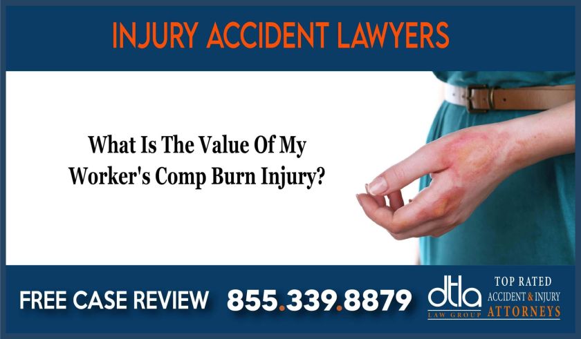 What Is The Value Of My Workers Comp Burn Injury Lawsuit incident liability lawsuit attorney