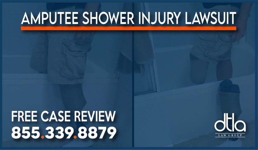 amputee shower injury lawyer attorney compensation lawsuit