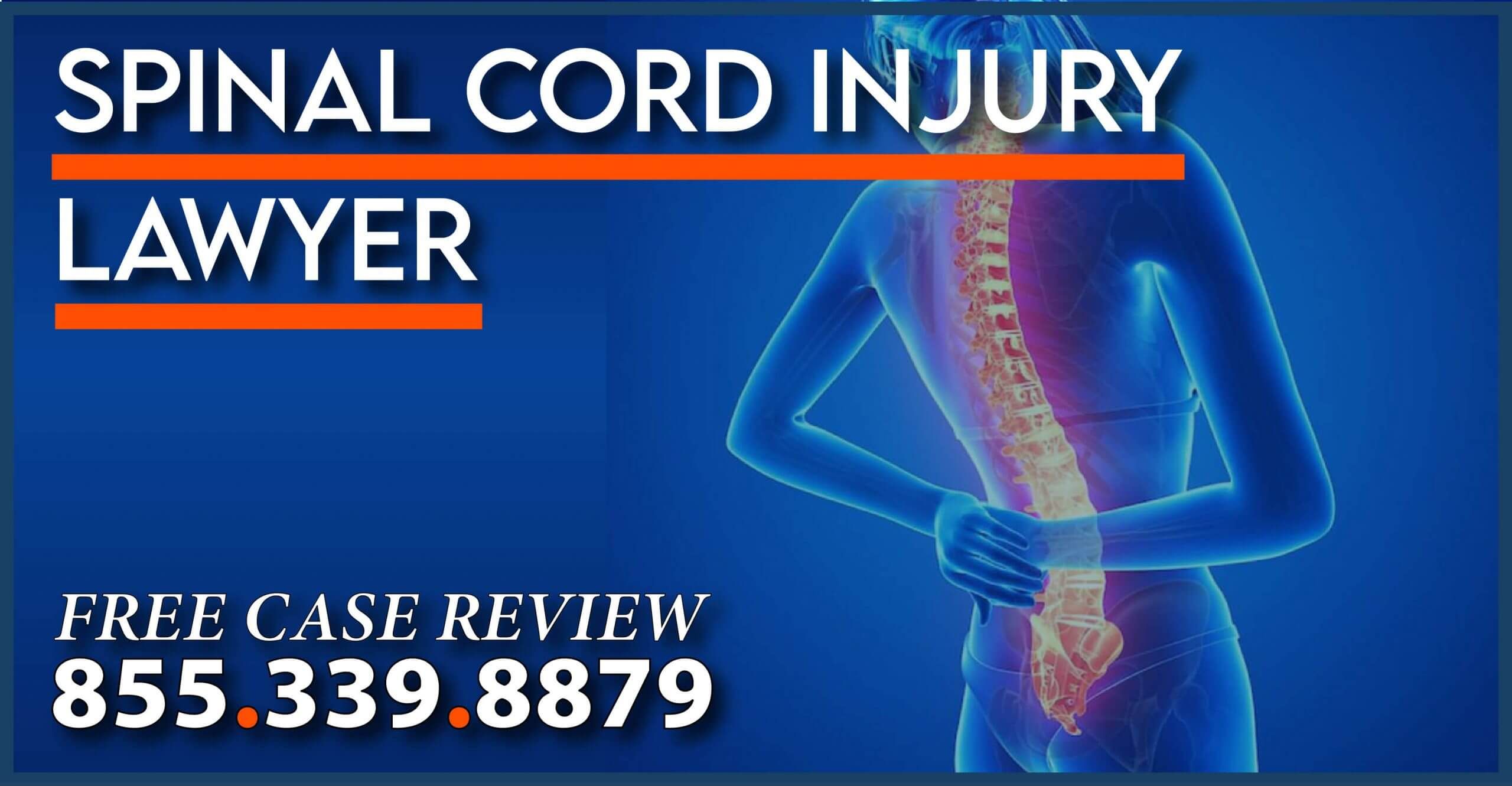 spinal cord injury lawyer negligence incident accident attorney sue compensation