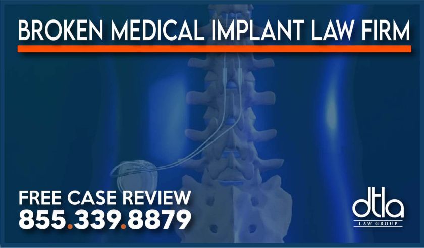 Broken Medical Implant Law Firm spinal cord stimulator lawsuit malpractice lawyer attorney incident sue