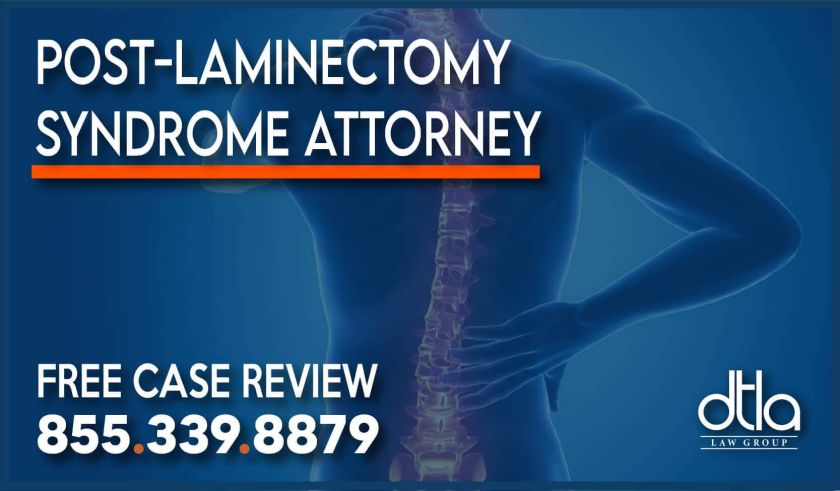 Post-Laminectomy Syndrome Attorney lawyer sue compensation personal injury