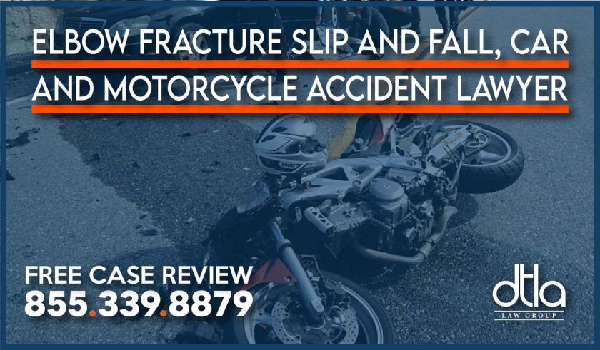 Elbow Fracture Slip and Fall, Car and Motorcycle Accident Lawyer attorney sue compensation lawsuit case personal injury incident accident