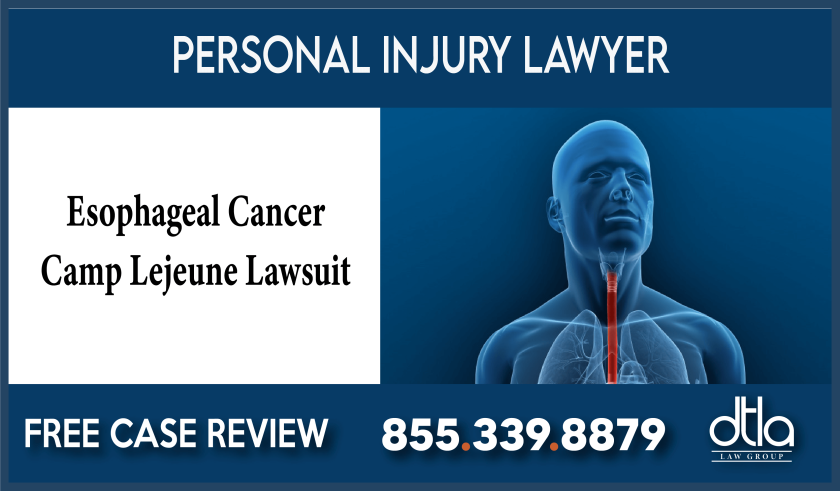 Lawyer for Esophageal Cancer Camp Lejeune Lawsuit attorney sue compensation lawyer