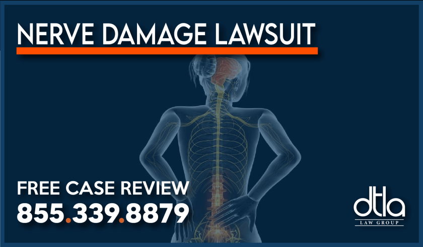 Nerve Damage – Compensation for Nerve Injury and Nerve Pain attorney lawyer lawsuit