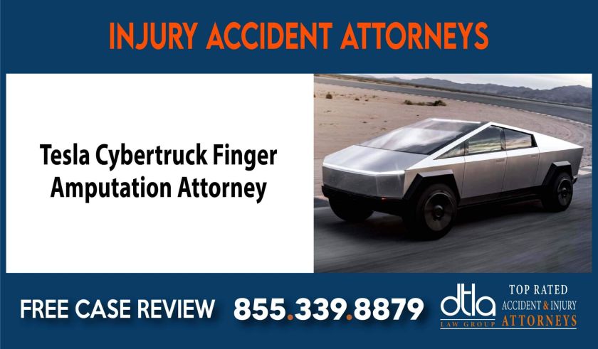 Tesla Cybertruck Finger Amputation Attorney lawsuit liability compensation lawyer attorney sue