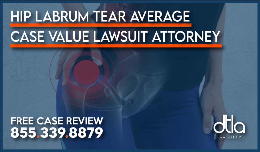 Hip Labrum Tear Average Case Value Slip and Fall Car Accident Lawsuit Attorney lawyer incident sue compensation case