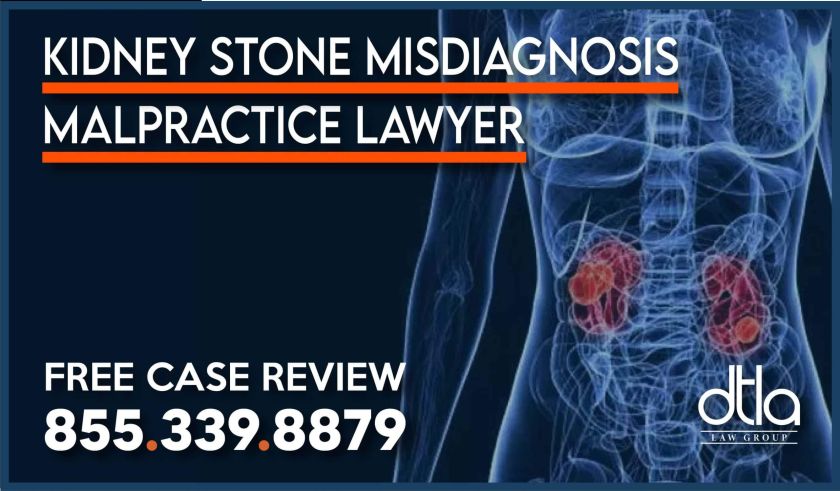kidney stone misdiagnosis medical malpractice lawyer attorney sue