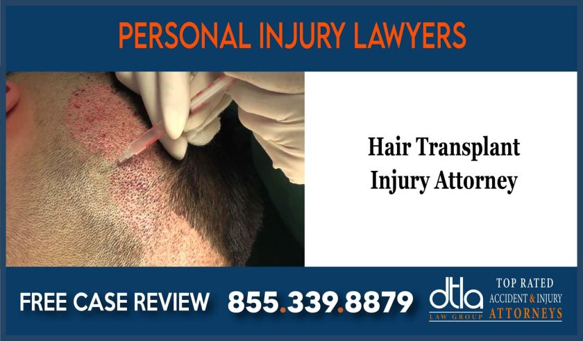 Hair Transplant Injury Attorney sue lawsuit compensation incident-06