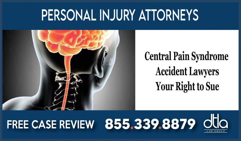 Central Pain Syndrome Accident Lawyers Your Right to Sue personal injury attorney incident sue compensation