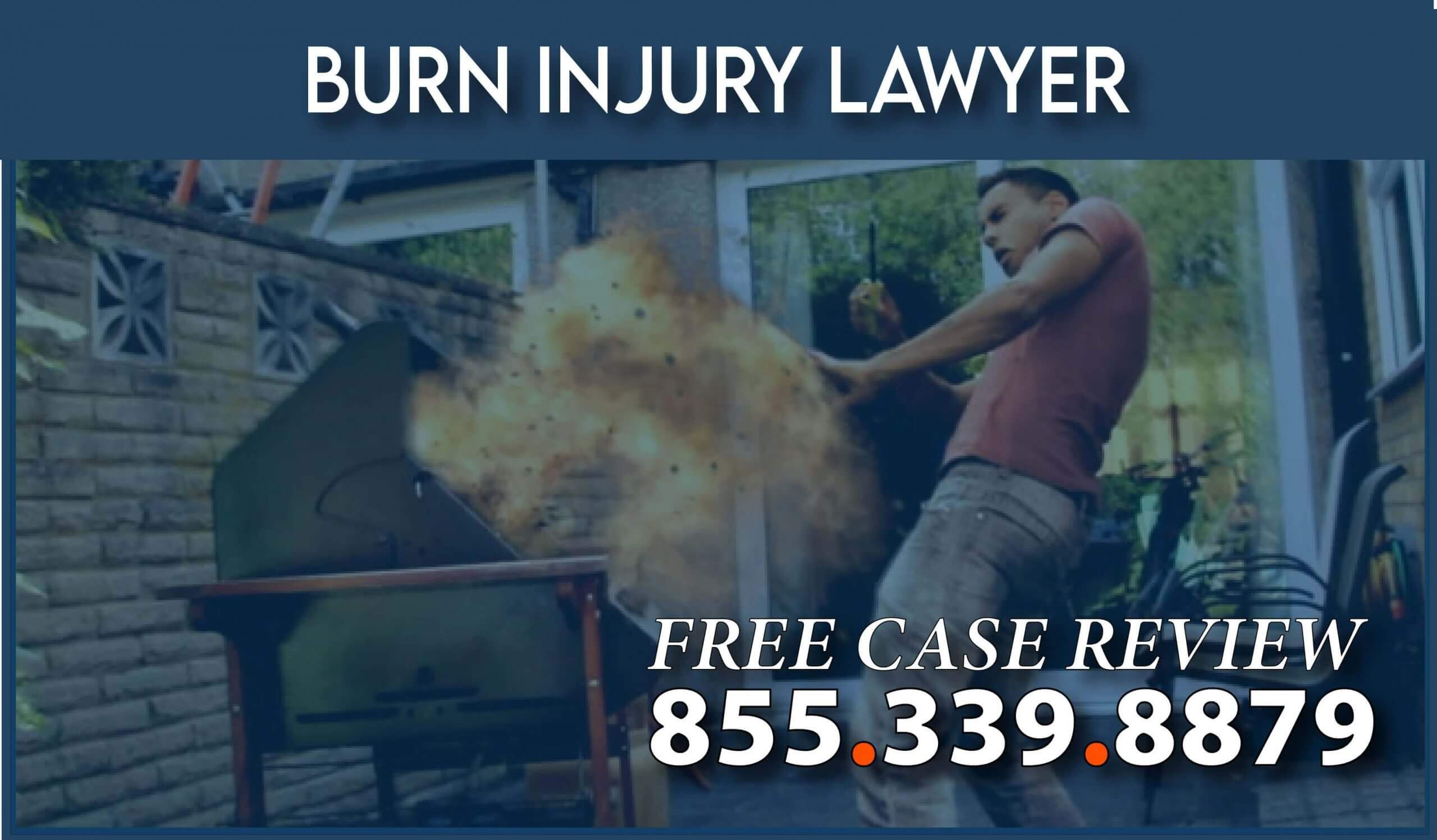 barbecue grill defect explosion burn injury lawyer compensation sue