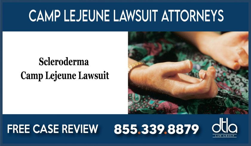 Lawyer for Scleroderma Camp Lejeune Lawsuit liability lawyer attorney sue compensation