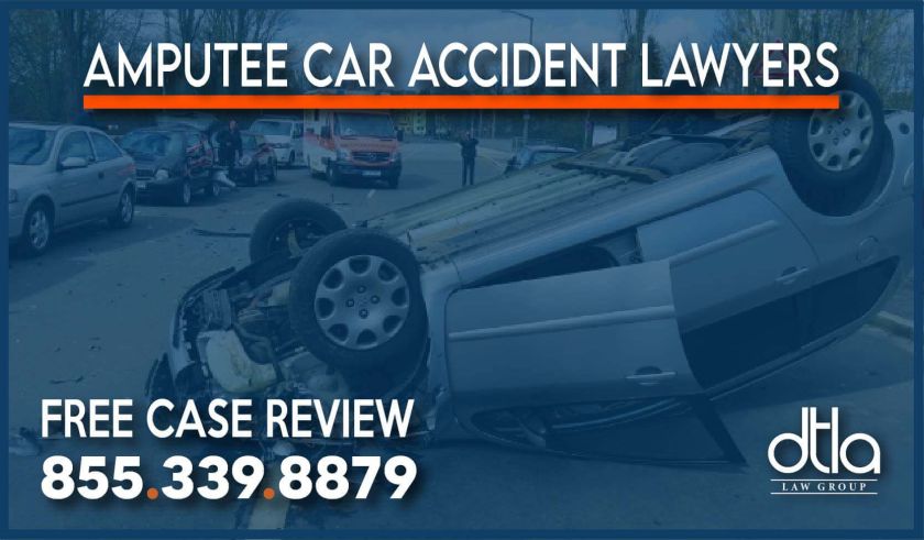 Amputee Car Accident lawyers lawsuit attorney sue compensation incident