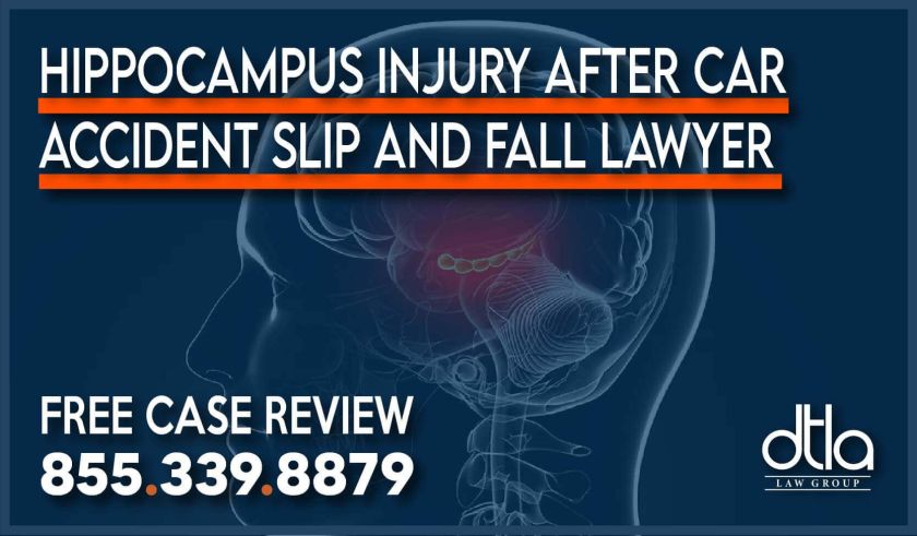 Hippocampus Injury after Car Accident – Slip and Fall Lawyer sue compensation personal injury incident liability