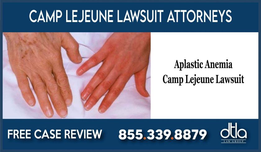 aplastic anemia lawsuit camp lejeune lawyer attorney sue compensation liability