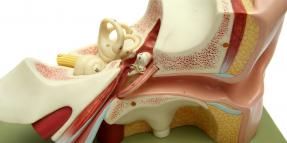 Statute of Limitations for Cochlear Implant Lawsuit | Product Liability