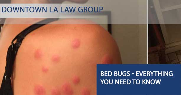 Bed Bugs - Everything you need to know
