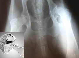 Attorney for Defective Medical Implants and Devices