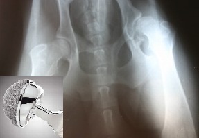 DuPuy Hip Replacement Attorney  California