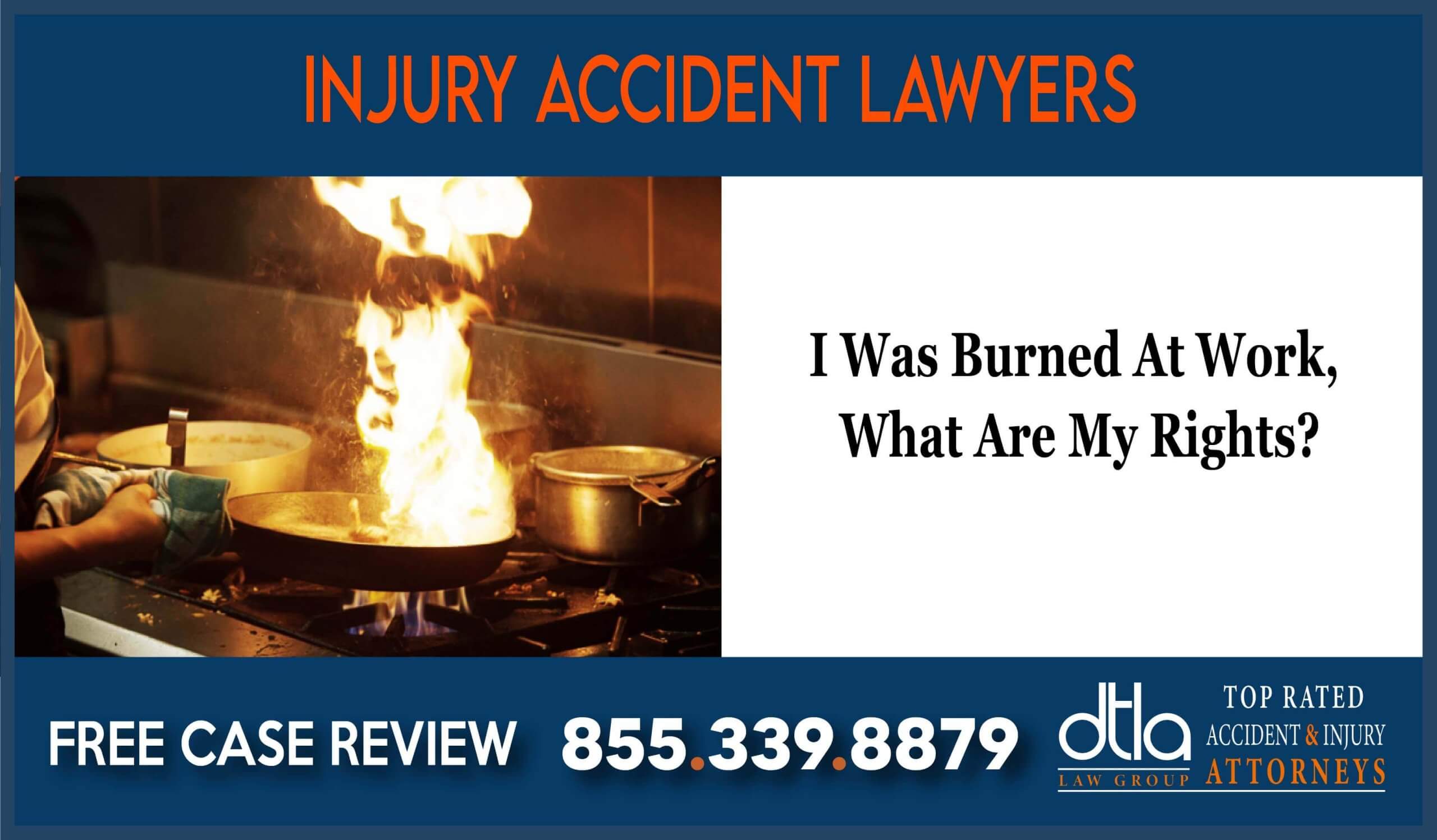 I Was Burned At Work What Are My Rights lawyer attorney sue lawsuit compensation incident accident