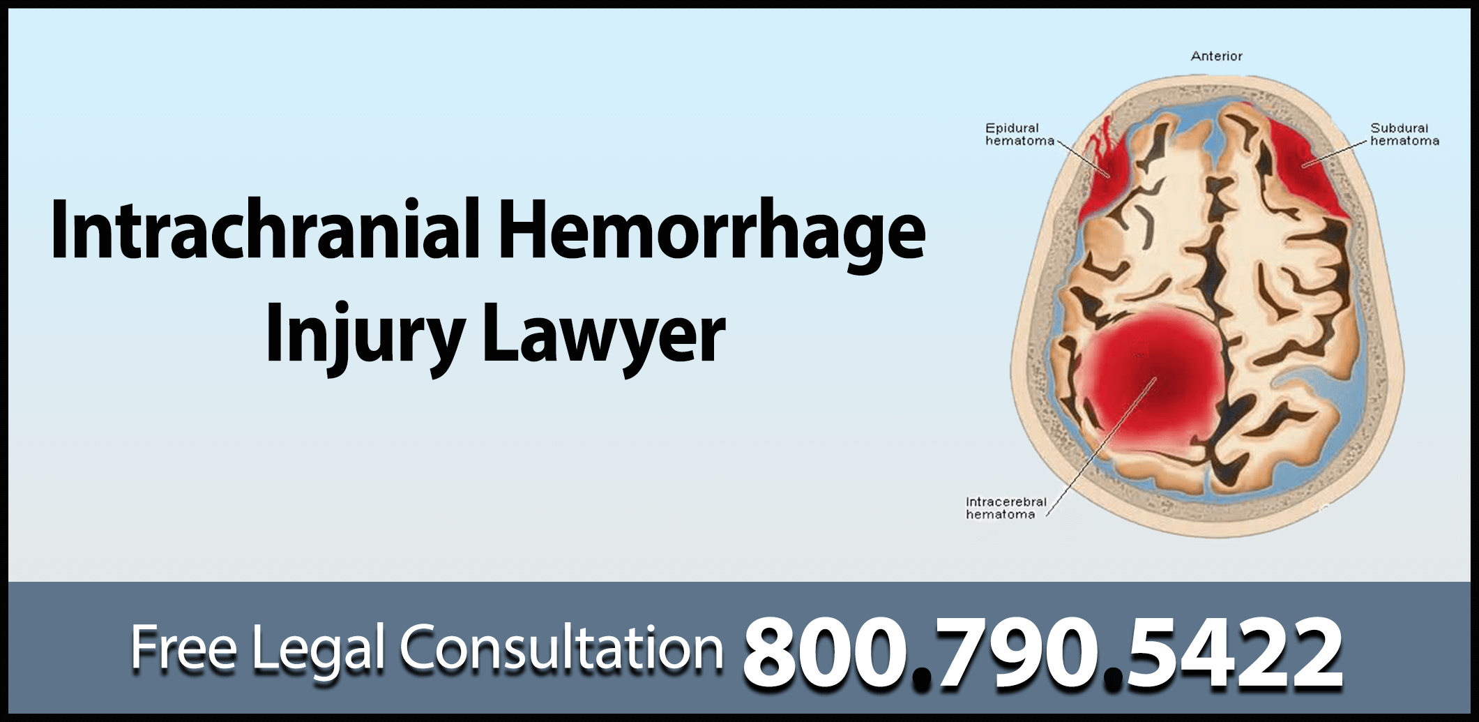 Intrachranial hemorrhage injury personal lawyer blood vessel sleep apnea seizuure compensation sue attorney lethargy consciousness shallow breathing