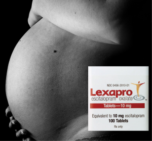 Lexapro Lawsuits: Birth Defects caused by the use of Antidepressant
