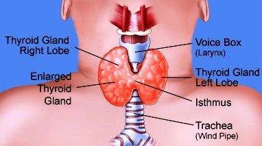 Victoza Thyroid Cancer Attorney