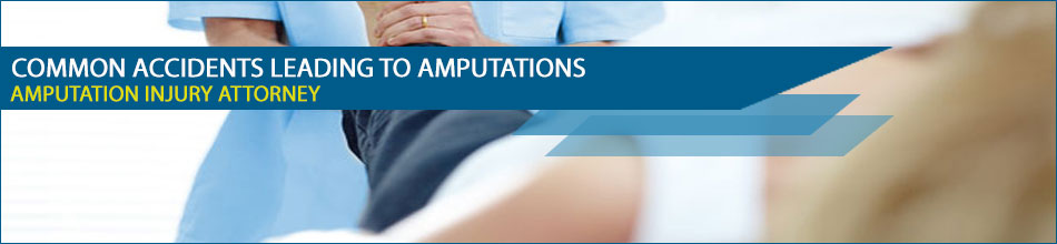 Amputation Accident and Injury Attorney Los Angeles