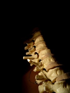 Workplace Back Pain Attorney