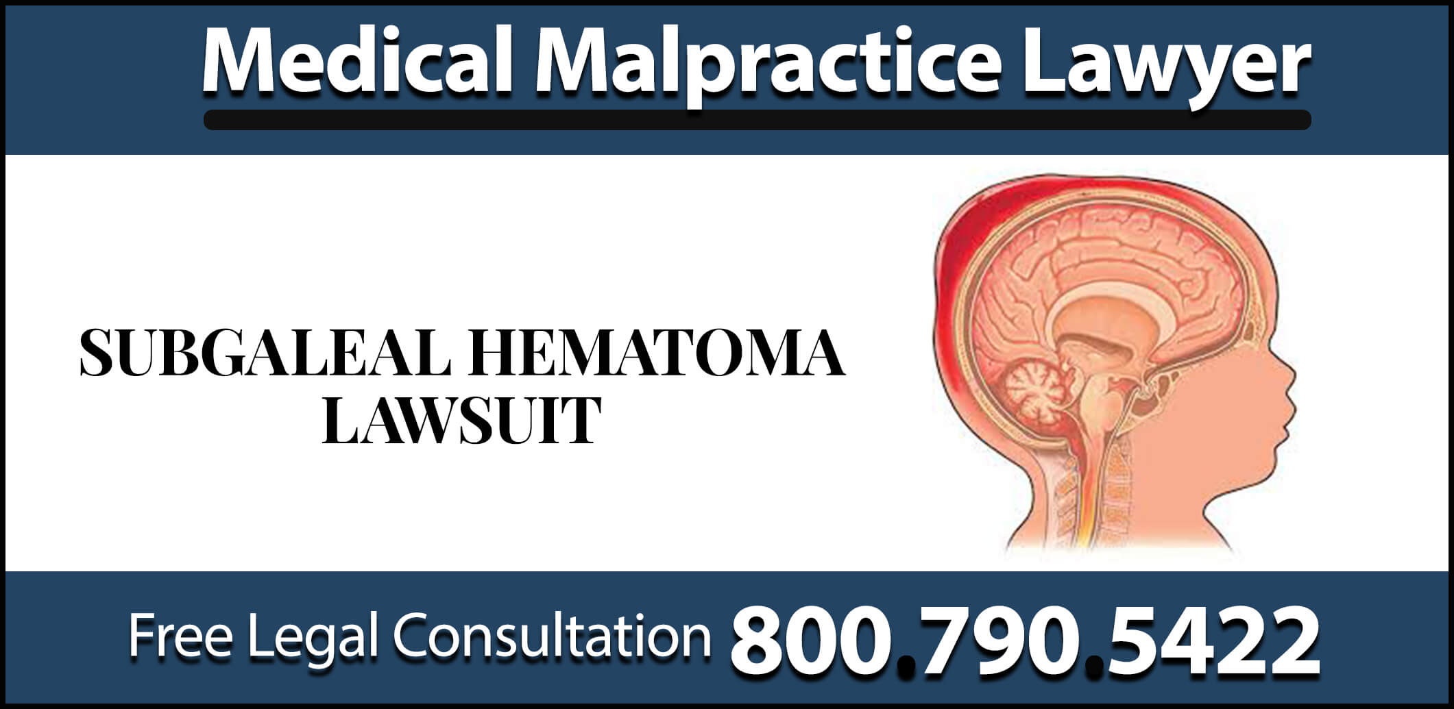 subgaleal hematoma lawsuit medical malpractice lawyer attorney sue compensation liability blood clot seizure brain damage compensation sue